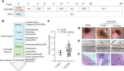 PDIA2 Bridges Endoplasmic Reticulum Stress and Metabolic Reprogramming During Malignant Transformation of Chronic Colitis